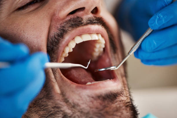 Best Sedation Dentistry  in Rancho Tehama Reserve, CA